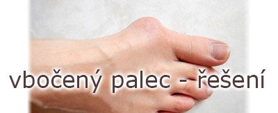 Vbočený palec: Jak se projevuje a jaká obuv je pro něj nejvhodnější | ARNO.cz - obuv s tradicí